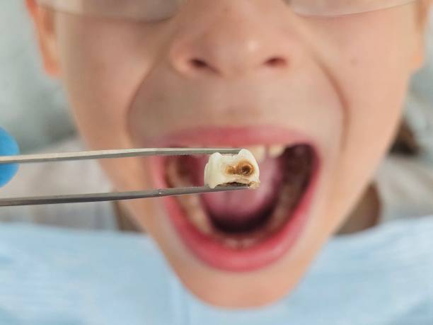 Best Broken or Chipped Tooth Repair in Amherst, WI