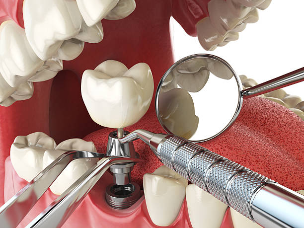 Best Emergency Care for Gum Disease in Amherst, WI
